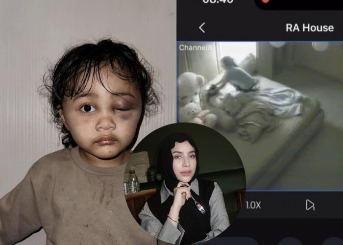 VIRAL! Anak Selebgram Emy Aghnia Dianiaya Baby Sitter, Netizen : Suster Biadab