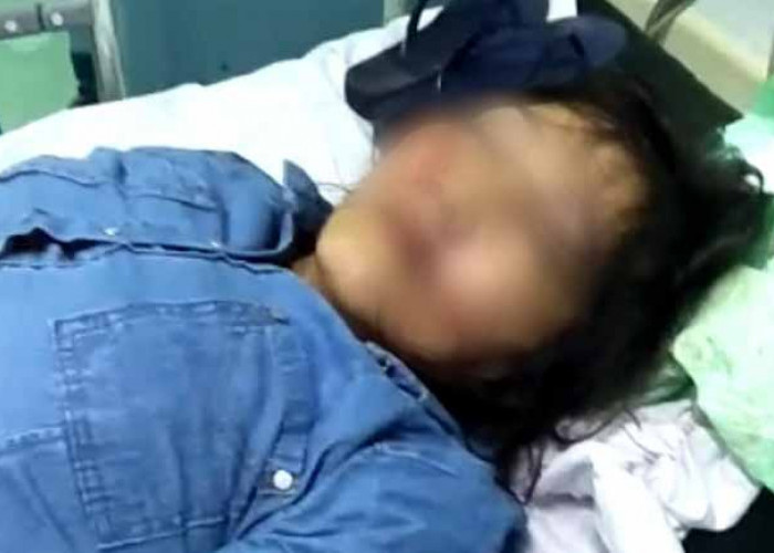 Seorang Wanita di Palembang Diduga Korban Jambret, Ditemukan Tidak Sadarkan Diri 