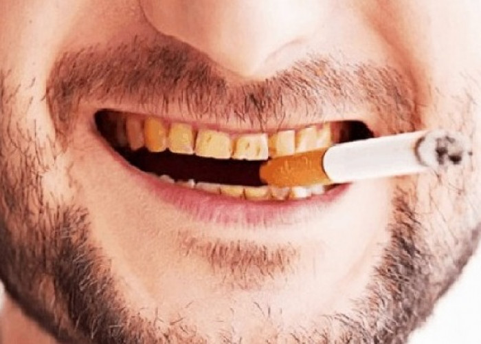 Wow! Ternyata Asap Rokok Bikin Senyum Pria Menyeramkan, Jangan Dibiarkan Bisa Manakutkan