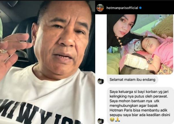 Hotman Paris Siap Ketemu, Respon Pengaduan Keluarga Bayi Jari Putus Tergunting di RS Muhammadiyah Palembang