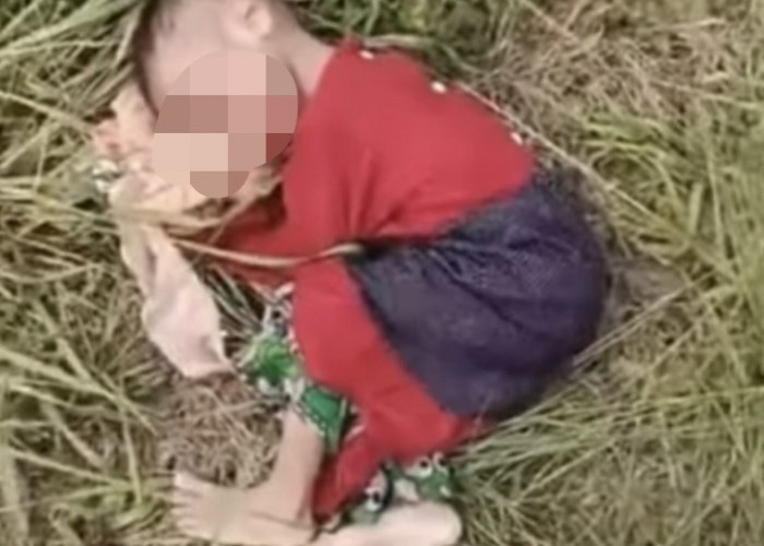 Miris! Bocah Perempuan 3 Tahun Penderita Gizi Buruk, Ditemukan Tergeletak Tak Berdaya di Semak-Semak