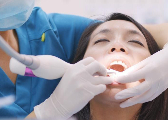 Belum Banyak yang Tahu, BPJS Kesehatan Bisa Buat Bersihkan Karang Gigi