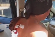 Pedagang Alami Luka Tusuk di Desa Embacang Mesuji Raya Diserang Saat Jualan