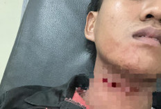 Leher Kena Tali Layangan Melintas di Jembatan Musi VI Palembang, Atlet Karate Butuh Donatur Biaya Operasi 