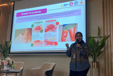Peringati Hari Kanker Sedunia, RS Siloam Sriwijaya Gelar Edukasi Deteksi Dini Lewat Sharing Session Edukasi