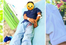 Pemuda di Kayuagung Jadi Korban Penembakan, Polisi Lakukan Penyelidikan