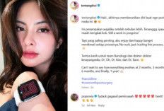 Tiwi T2 Pamer Penampilan Terbaru Lebih dari Sebulan Usai Operasi Plastik