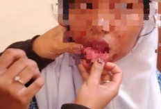 Viral Perundungan Dipicu Senggolan Bahu di Kantin Sekolah, Disdik Palembang Monitoring Karakter Siswa