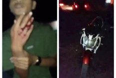 Jalan Rusak di Tanjung Batu Ogan Ilir Makan Korban, Pengendara Motor Kecelakaan Tunggal, Jari Manis Putus