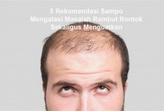  Ini 5 Rekomendasi Sampo yang Bisa Mengatasi Masalah Rambut Rontok Sekaligus Menguatkan
